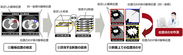 図1 画像比較による腫瘍の経時変化の観察