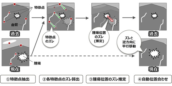 図2 自動位置合わせの基本的な考え方