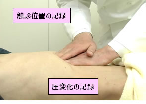 図1 漢方医療の触診の様子