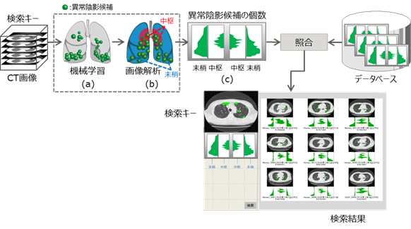 図3 開発した類似症例検索技術