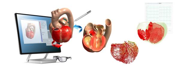 図.心臓ビューアーの立体視イメージ