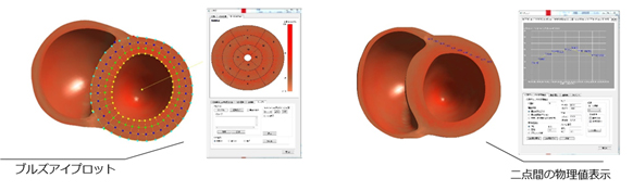 心筋にかかる圧力などの物理的な値をグラフで可視化