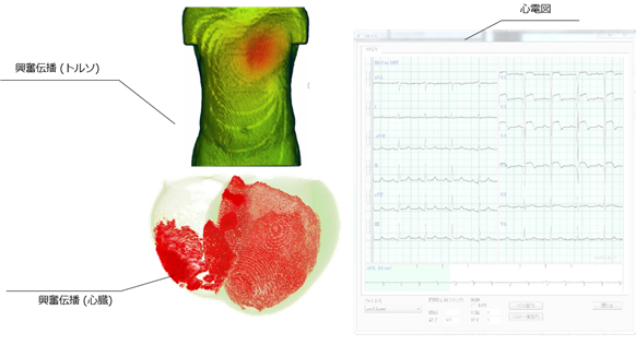 心電図と興奮伝播の関係を学習