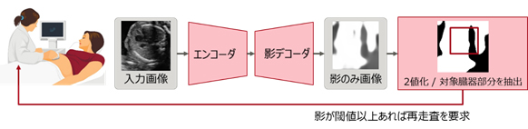 図3. 超音波検査画像の処理可否を判定する方法の例
